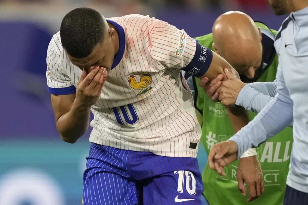 Kylian Mbappé Suffers Broken Nose in Euro Winillustration